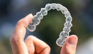 increase your confidence level with invisalign braces